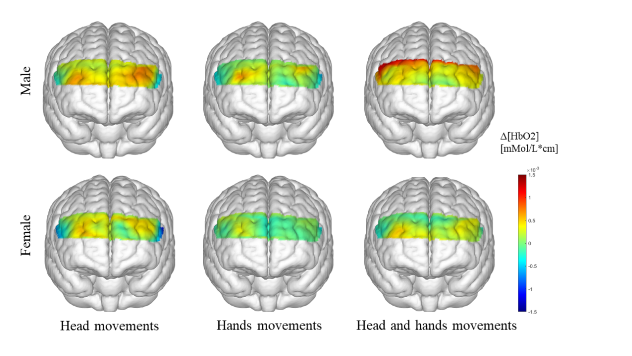 fNIRS response patterns under different feedback conditions