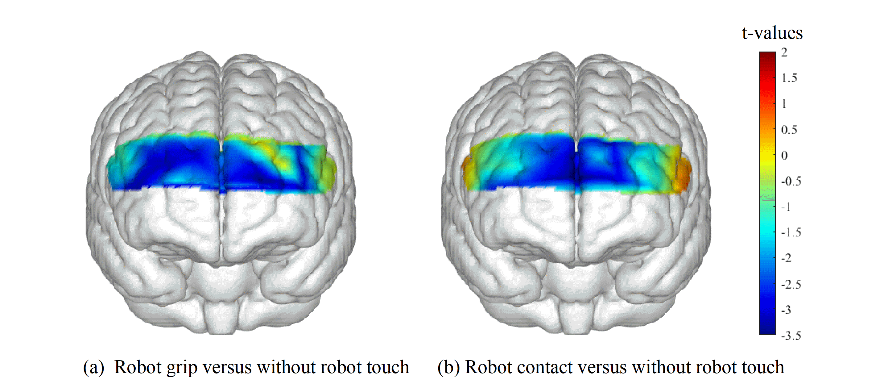 Physiological and neural outcomes of humanoid touch intervention